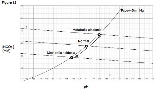 metabolic alkalosis